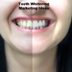 Teeth Whitening